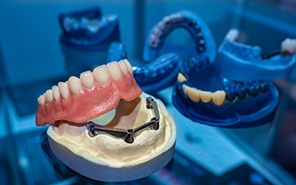 An example of implant dentures in Glastonbury