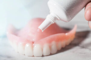 Denture adhesive cream being applied to upper denture